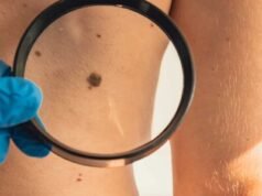 Cuba desarrolla tratamiento para el cáncer de piel, en medio de crisis