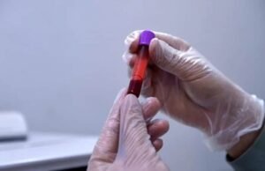 Estudio valida la sangre capilar para el control antidopaje
