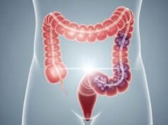 Llaman a mayores de 45 a chequeos para prevenir cáncer de colon