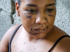 Las heridas que cura Nayely