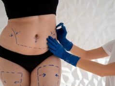 Someterse a procedimientos en una cirugía estética está permitido